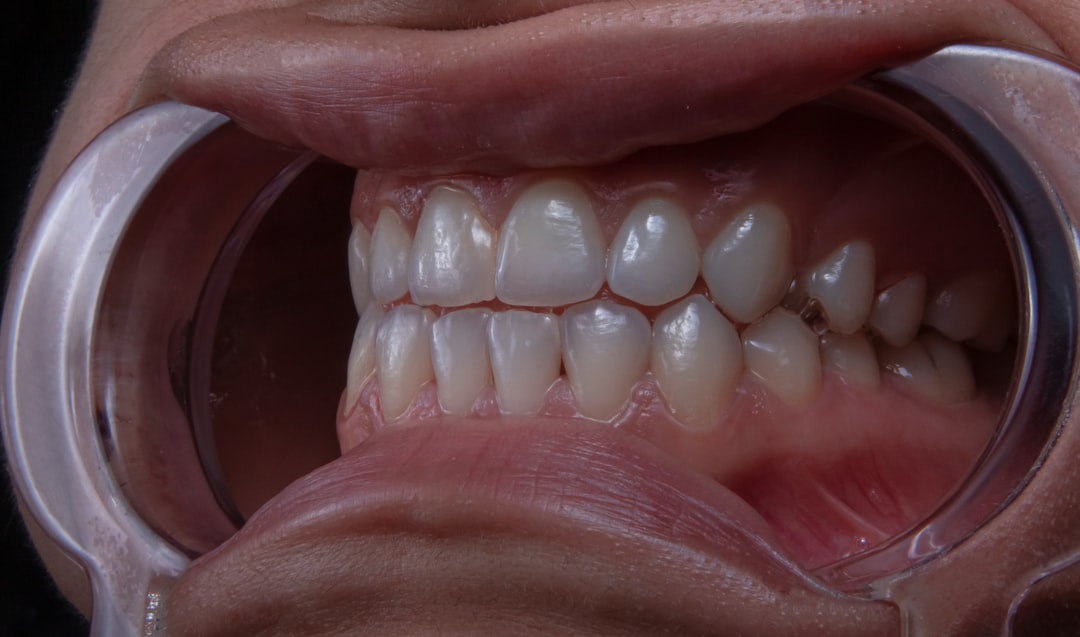 Photo Teeth whitening