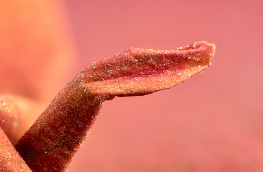 gingivitis