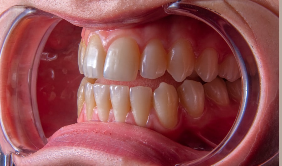 dentální hygiena