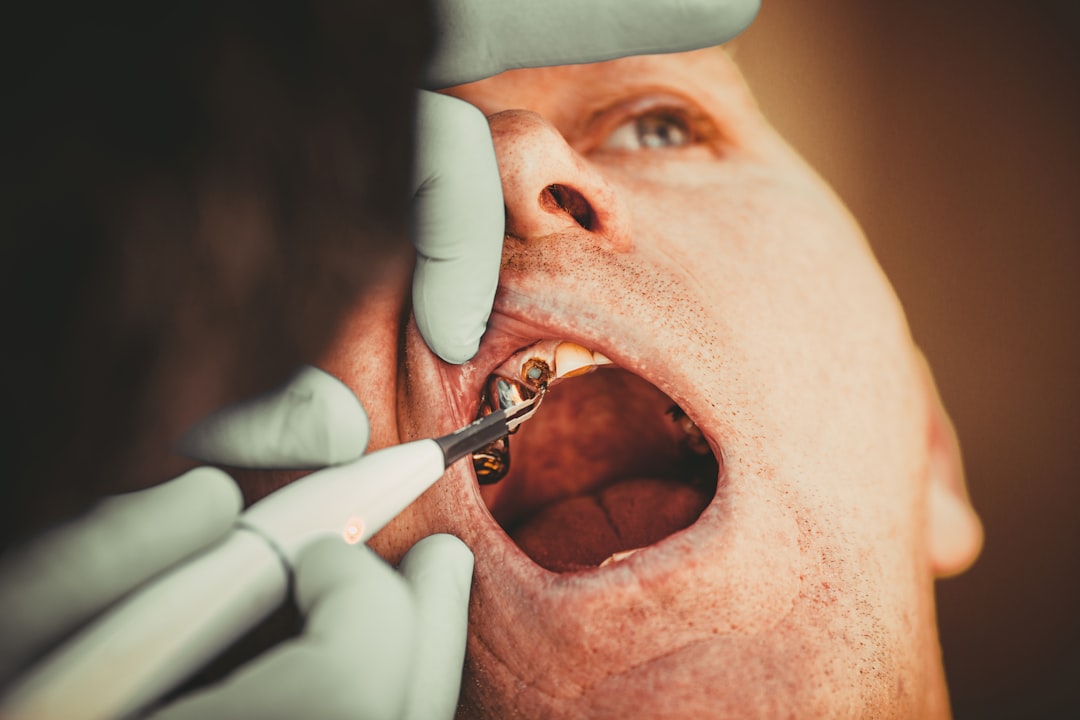 Photo dental calculus