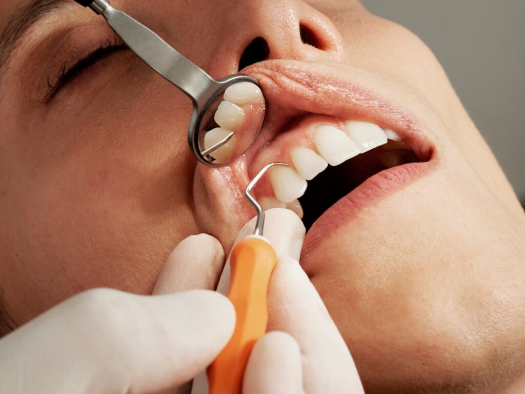 Photo dental hygiene