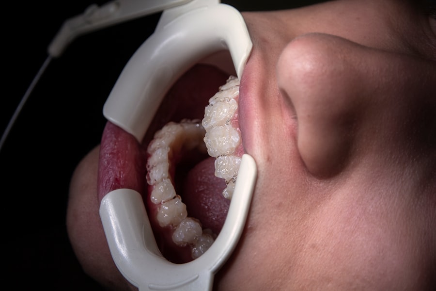 Photo teeth cleaning with braces