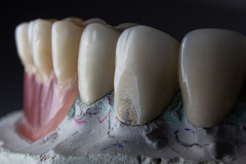 Photo teeth cleaning with braces