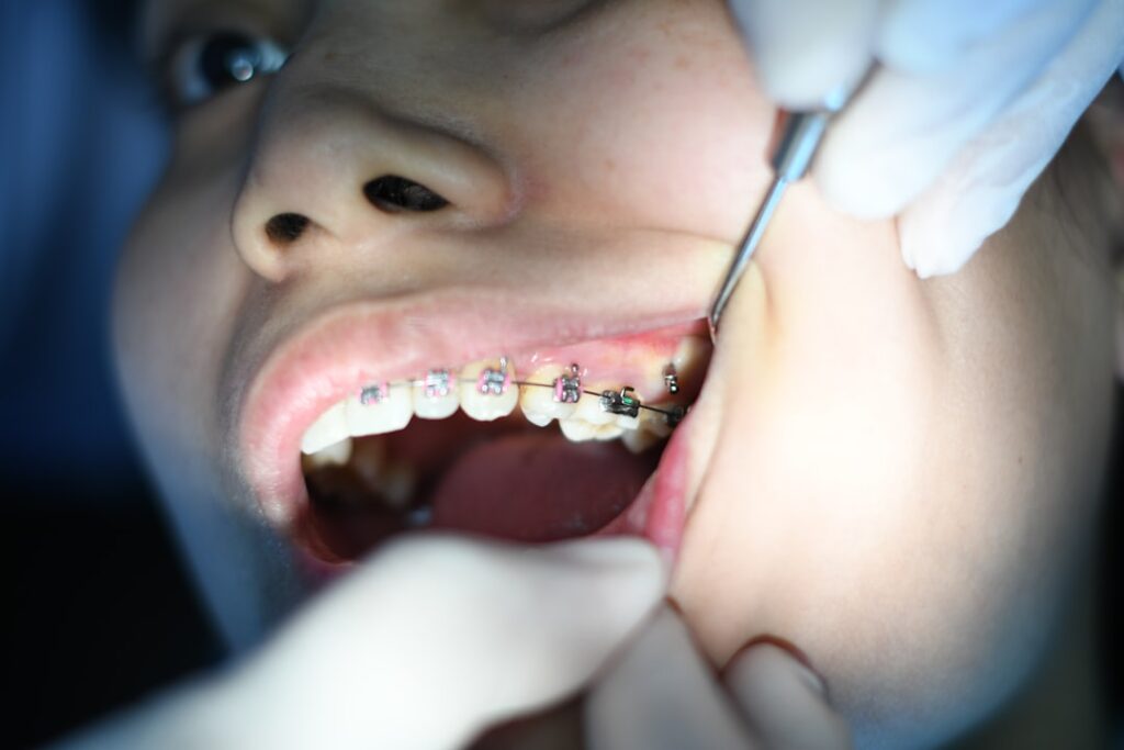 Photo dentální hygiena