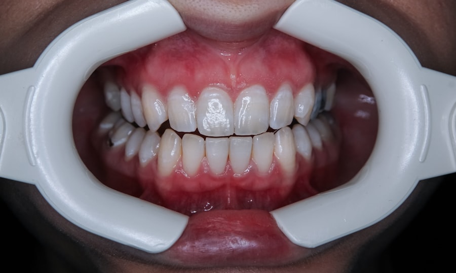 Photo dentální hygiena